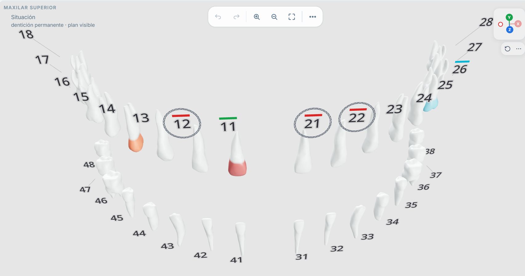 Odontograma 3D de DentiLaft con numeracion FDI y hallazgos clinicos
